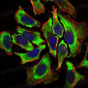 Anti-HAS2 Antibody (R3V61)