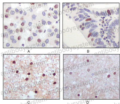 Anti-KAT5/TIP60 Antibody (R3V66)