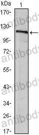 Anti-USP7 Antibody (R3V68)
