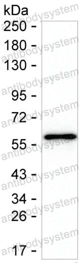 Anti-TSLP Antibody (R3V72)