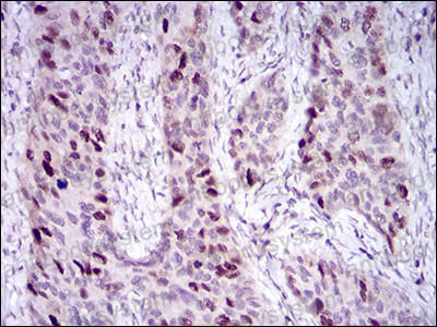 Anti-HDAC10 Antibody (R3V73)