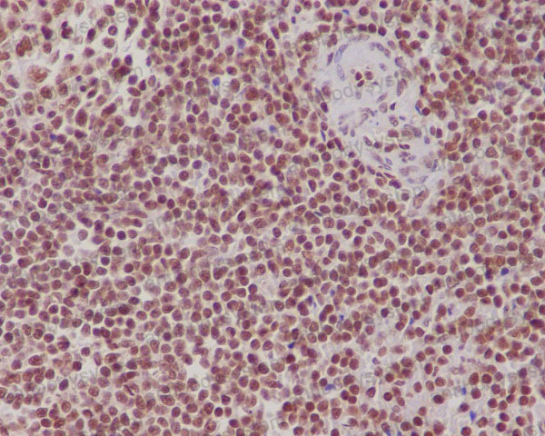 Anti-FUBP1 Antibody (R1A63)