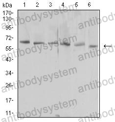 Anti-CD365/KIM-1/TIM-1/HAVCR1 Antibody (R3V76)