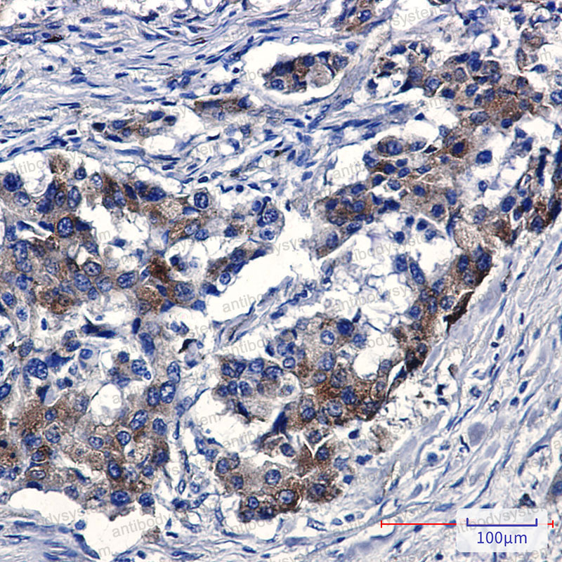 Anti-SORT1/Gp95/Sortilin Antibody (R2J83)