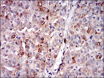 Anti-PLIN2 Antibody (R3V96)