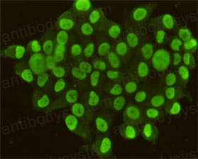 Anti-CDX2 Antibody (R3W03)