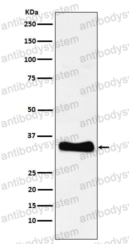 Anti-MGLL Antibody (R2J87)
