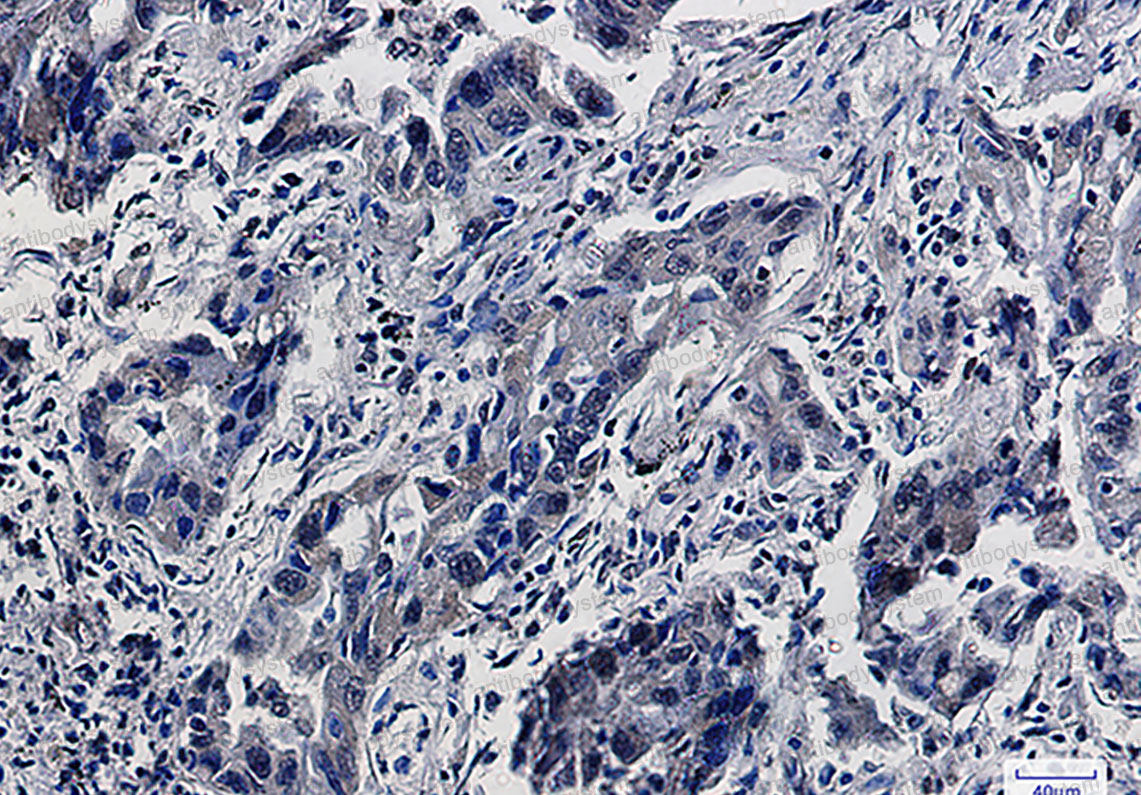 Anti-SMAD5 Antibody (R2J88)