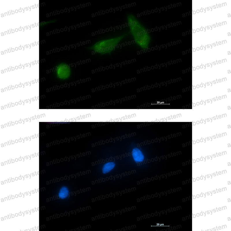 Anti-TSG101 Antibody (R2J92)