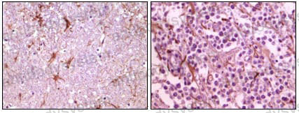 Anti-CIB1 Antibody (R3W13)