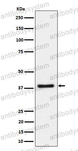 Anti-HAUS7 Antibody (R2J95)