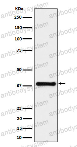 Anti-HAUS7 Antibody (R2J94)