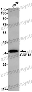 Anti-GDF15/MIC1 Antibody (R2J98)