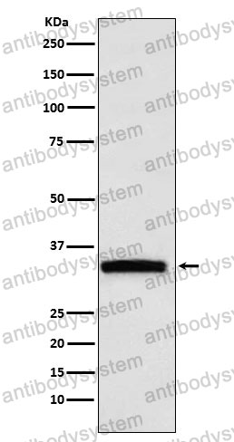 Anti-GDF15/MIC1 Antibody (R2J97)