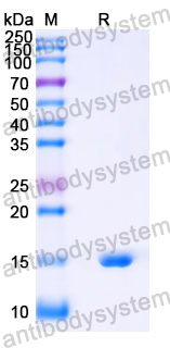 Anti-Human SOST Nanobody (SAA1265)