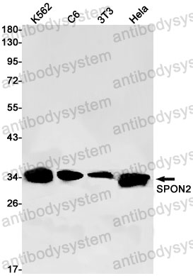 Anti-SPON2/Mindin Antibody (R2K01)