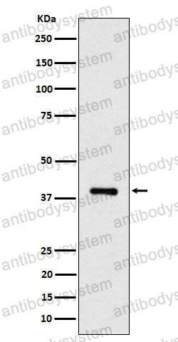 Anti-ACAT2 Antibody (R2K02)