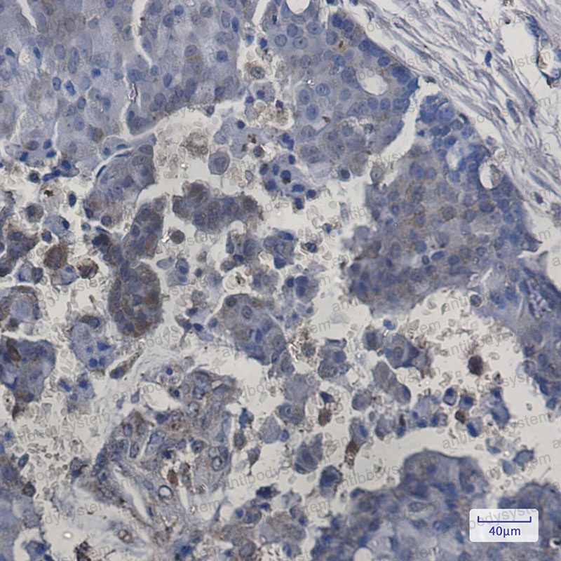 Anti-ITPA Antibody (R2K04)