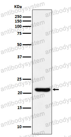 Anti-ITPA Antibody (R2K03)