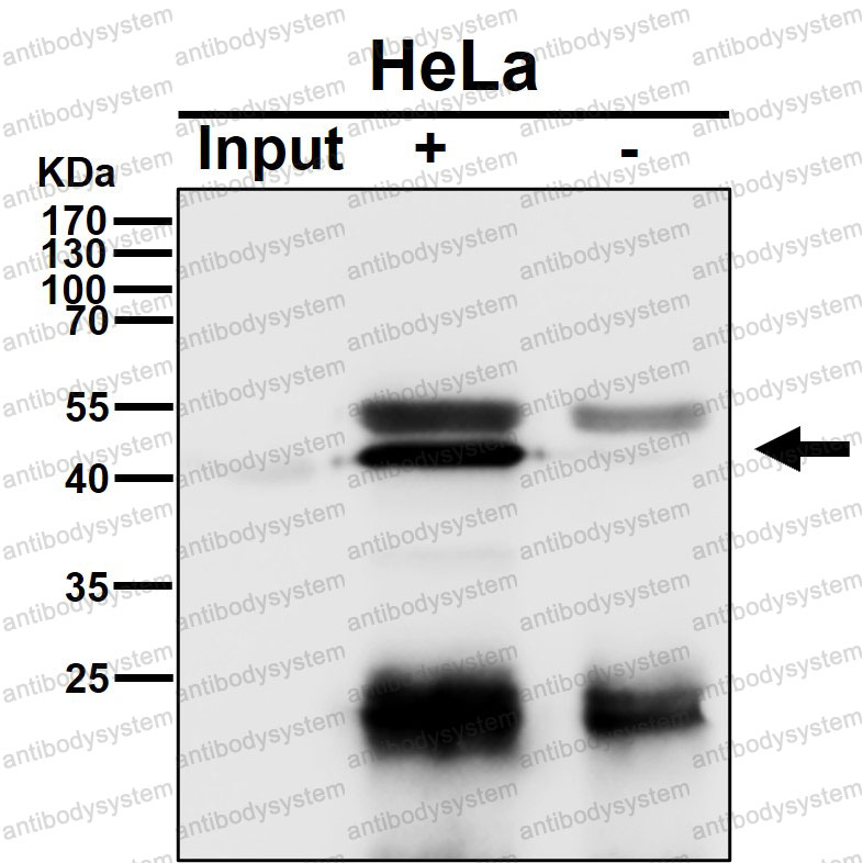 Anti-HDAC8 Antibody (R2K05)