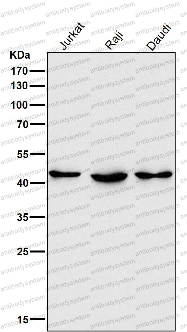 Anti-HDAC8 Antibody (R2K06)