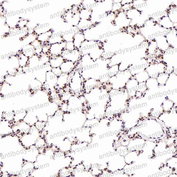 Anti-ACE2 Antibody (R2K09)
