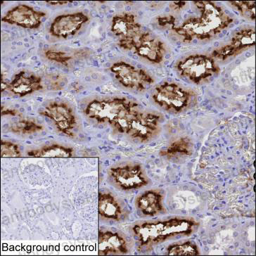 Anti-ACE2 Antibody (R3W22)