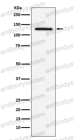 Anti-MDA5/IFIH1 Antibody (R2K10)