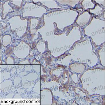 Anti-MDA5/IFIH1 Antibody (R3W23)