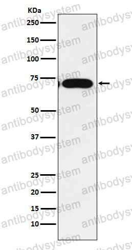Anti-CPEB1 Antibody (R2K11)