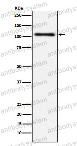 Anti-PRKD2 Antibody (R2K12)