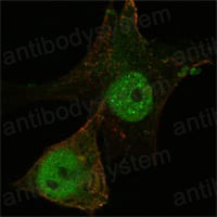 Anti-FOXP3 Antibody (R3W24)