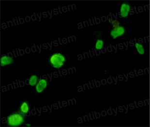 Anti-FOXP3 Antibody (R3W27)