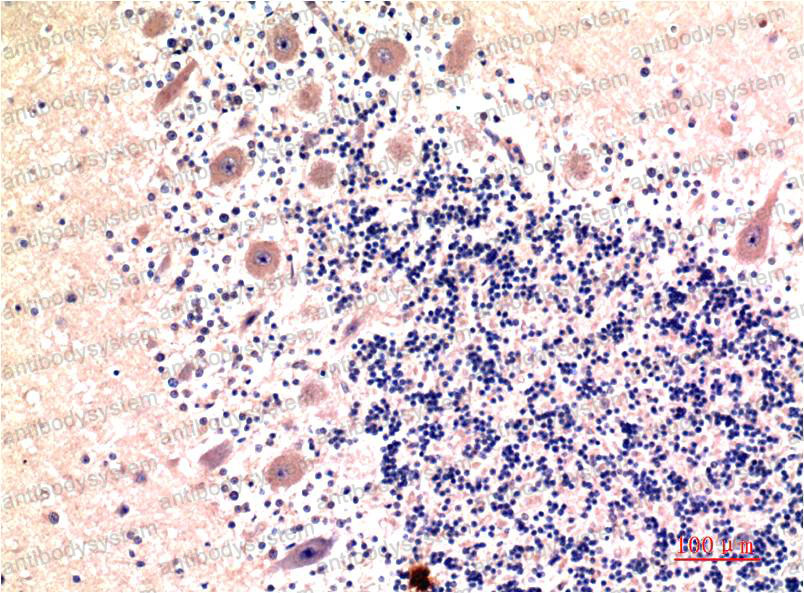 Anti-LC3B Antibody (R3W32)