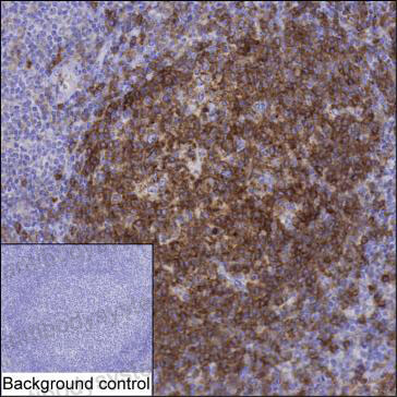 Anti-LAT2 Antibody (R3W34)