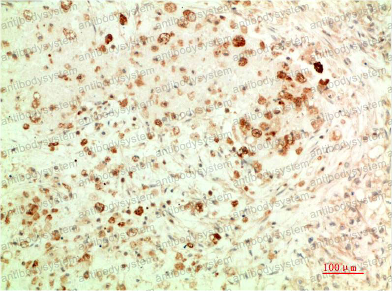 Anti-ATG5 Antibody (R3W38)