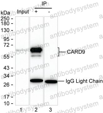 Anti-CARD9 Antibody (R3W40)