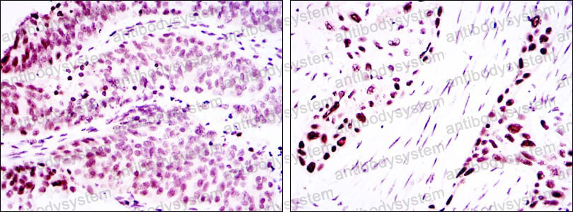 Anti-TP63/p40 Antibody (R3W46)