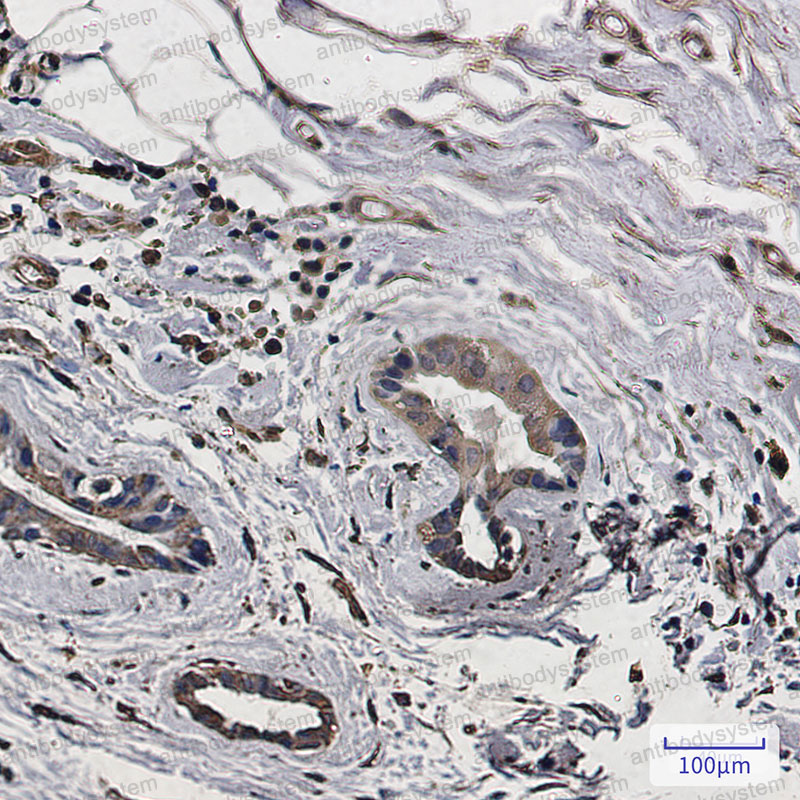 Anti-MAP1LC3A Antibody (R2K20)