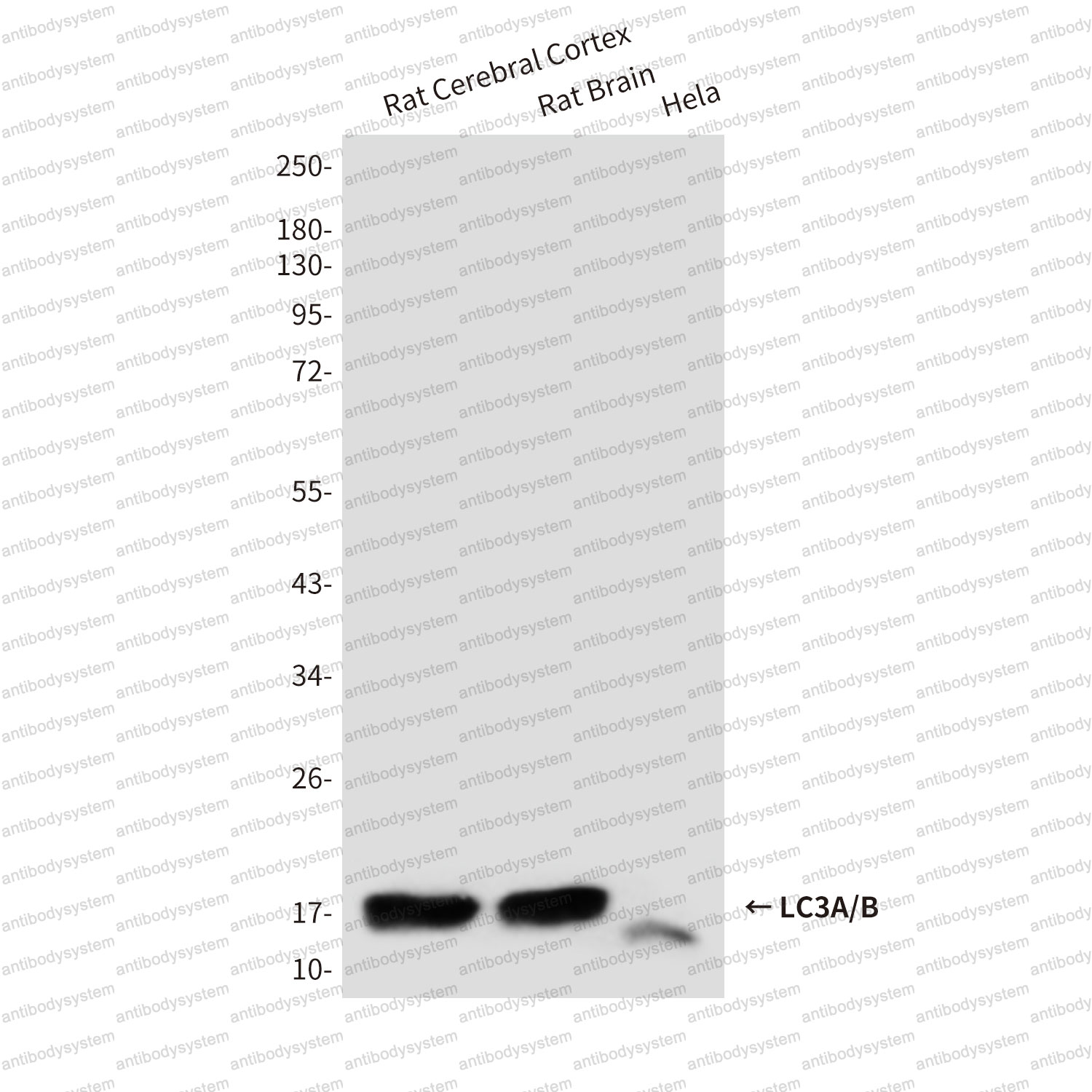 Anti-LC3A/B Antibody (R3W51)