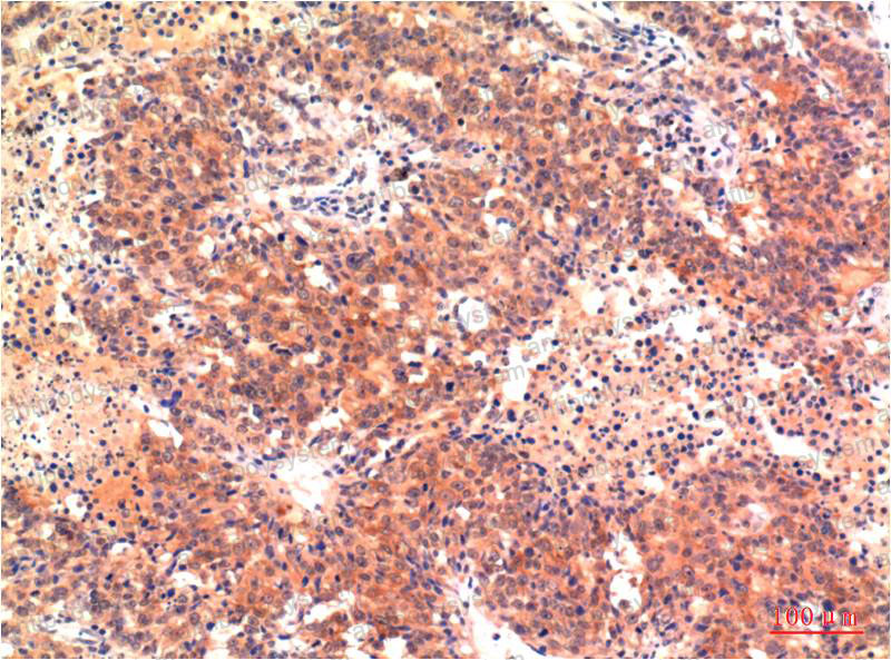 Anti-LC3A Antibody (R3W50)