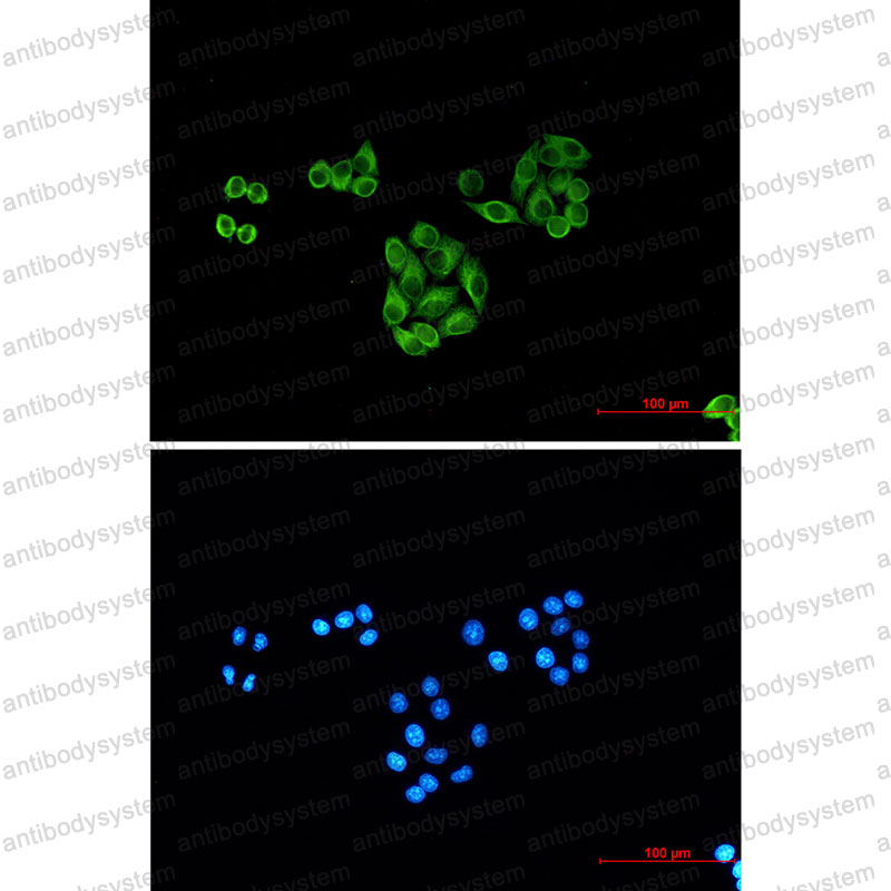 Anti-TUBB1/beta I Tubulin Antibody (R3W54)