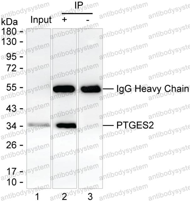 Anti-PTGES2 Antibody (R3W56)