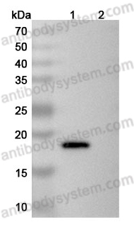 Anti-Human IL21 Antibody (SAA2070)