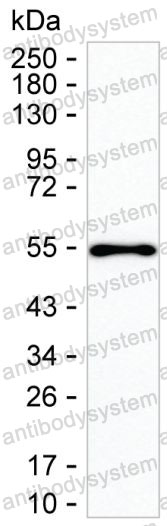 Anti-IL21 Antibody (R3W59)