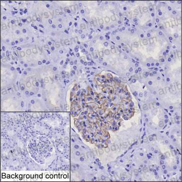 Anti-NPHS2 Antibody (R3W72)