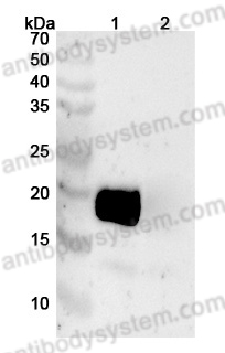 Anti-Human CD354/TREM1 Antibody (SAA2019)