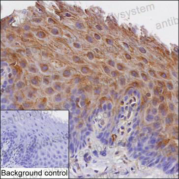 Anti-SPINK5 Antibody (R3W84)