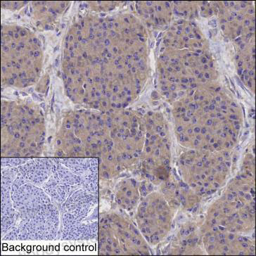 Anti-PLCB1 Antibody (R3W85)