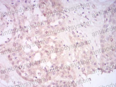 Anti-SIRT7 Antibody (R3W95)